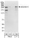 Terminal Uridylyl Transferase 4 antibody, A302-635A, Bethyl Labs, Western Blot image 
