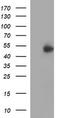 Interferon Gamma Receptor 2 antibody, M03158, Boster Biological Technology, Western Blot image 