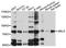 Maternal Embryonic Leucine Zipper Kinase antibody, A10794, ABclonal Technology, Western Blot image 