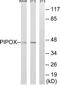Peroxisomal sarcosine oxidase antibody, TA315459, Origene, Western Blot image 
