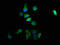 Tyrosinase antibody, LS-C370509, Lifespan Biosciences, Immunofluorescence image 