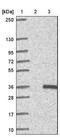 2-Aminoethanethiol Dioxygenase antibody, NBP1-88530, Novus Biologicals, Western Blot image 