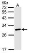 Calbindin 2 antibody, TA308723, Origene, Western Blot image 