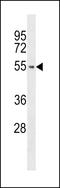 Protein Tyrosine Kinase 6 antibody, LS-C99386, Lifespan Biosciences, Western Blot image 