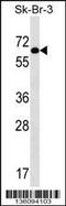 Thyroid Hormone Receptor Interactor 4 antibody, 58-606, ProSci, Western Blot image 