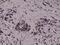 HIF1A antibody, M00013-1, Boster Biological Technology, Immunohistochemistry frozen image 