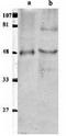 Tyrosyl-DNA Phosphodiesterase 2 antibody, TA309898, Origene, Western Blot image 