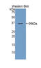 Carbonic Anhydrase 12 antibody, LS-C293155, Lifespan Biosciences, Western Blot image 