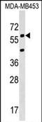 Potassium Voltage-Gated Channel Modifier Subfamily S Member 3 antibody, PA5-71996, Invitrogen Antibodies, Western Blot image 