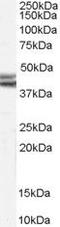 Neuropeptide Y Receptor Y2 antibody, PA5-18660, Invitrogen Antibodies, Western Blot image 