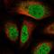 Ataxin 3 Like antibody, NBP1-93456, Novus Biologicals, Immunocytochemistry image 