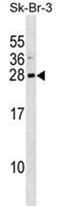 ARF7 antibody, AP50241PU-N, Origene, Western Blot image 