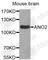 Anoctamin 2 antibody, A3684, ABclonal Technology, Western Blot image 