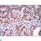 Kinesin Family Member 22 antibody, LS-C812670, Lifespan Biosciences, Immunohistochemistry paraffin image 