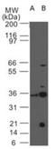 Interleukin 3 Receptor Subunit Alpha antibody, NBP2-27225, Novus Biologicals, Western Blot image 