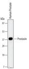 Serine Protease 8 antibody, MA5-24232, Invitrogen Antibodies, Western Blot image 