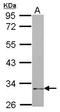 Natural Cytotoxicity Triggering Receptor 1 antibody, GTX115238, GeneTex, Western Blot image 