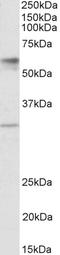 Solute Carrier Family 17 Member 5 antibody, EB11984, Everest Biotech, Western Blot image 