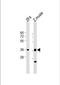 Melanocortin 4 Receptor antibody, PA5-72246, Invitrogen Antibodies, Western Blot image 