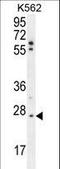 TNF Alpha Induced Protein 8 antibody, LS-C162053, Lifespan Biosciences, Western Blot image 