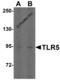 Toll Like Receptor 5 antibody, 3649, ProSci Inc, Western Blot image 