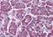 TNF Receptor Associated Factor 2 antibody, orb19446, Biorbyt, Immunohistochemistry paraffin image 