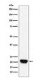 Ras Homolog, MTORC1 Binding antibody, M00827-1, Boster Biological Technology, Western Blot image 