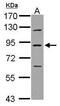 85 kDa calcium-independent phospholipase A2 antibody, PA5-27945, Invitrogen Antibodies, Western Blot image 