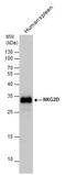 Killer Cell Lectin Like Receptor K1 antibody, NBP2-43645, Novus Biologicals, Western Blot image 