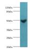 Mitogen-Activated Protein Kinase Kinase 5 antibody, LS-B15215, Lifespan Biosciences, Western Blot image 