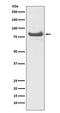 TNF Alpha Induced Protein 3 antibody, M00224, Boster Biological Technology, Western Blot image 