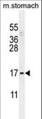 Zinc Finger Protein 428 antibody, LS-C160872, Lifespan Biosciences, Western Blot image 