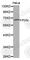 Paxillin antibody, A3065, ABclonal Technology, Western Blot image 