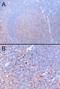 SET Domain And Mariner Transposase Fusion Gene antibody, orb18416, Biorbyt, Immunohistochemistry paraffin image 