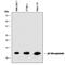 Beta-2-Microglobulin antibody, MAB8325, R&D Systems, Western Blot image 