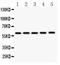 Cystathionine-Beta-Synthase antibody, LS-C357451, Lifespan Biosciences, Western Blot image 