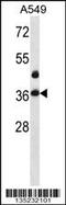 LIM And SH3 Protein 1 antibody, 58-151, ProSci, Western Blot image 