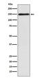 Collagen Type XI Alpha 1 Chain antibody, M02909, Boster Biological Technology, Western Blot image 