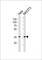 NFKB Inhibitor Alpha antibody, F52272-0.4ML, NSJ Bioreagents, Western Blot image 