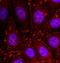 Phosphoinositide-3-Kinase Regulatory Subunit 1 antibody, orb14711, Biorbyt, Immunofluorescence image 