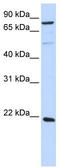 ADP Ribosylation Factor Like GTPase 11 antibody, TA340294, Origene, Western Blot image 