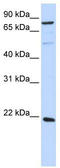 ARLTS1 antibody, TA340294, Origene, Western Blot image 