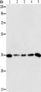 Aurora Kinase C antibody, TA350902, Origene, Western Blot image 