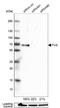 FUS RNA Binding Protein antibody, NBP1-89113, Novus Biologicals, Western Blot image 