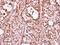 THO Complex 1 antibody, GTX102919, GeneTex, Immunohistochemistry paraffin image 