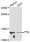 Transthyretin antibody, LS-B15343, Lifespan Biosciences, Western Blot image 