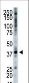 Tribbles Pseudokinase 3 antibody, LS-C100925, Lifespan Biosciences, Western Blot image 