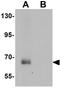 Spermatogenesis Associated 18 antibody, GTX32044, GeneTex, Western Blot image 
