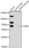 Tyrosyl-TRNA Synthetase antibody, GTX33565, GeneTex, Immunoprecipitation image 