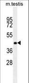 Zinc Finger Protein 622 antibody, LS-C160919, Lifespan Biosciences, Western Blot image 